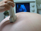 Ultrasound Prenatal Care Options