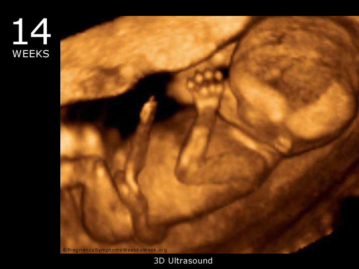 14 week ultrasound 3D