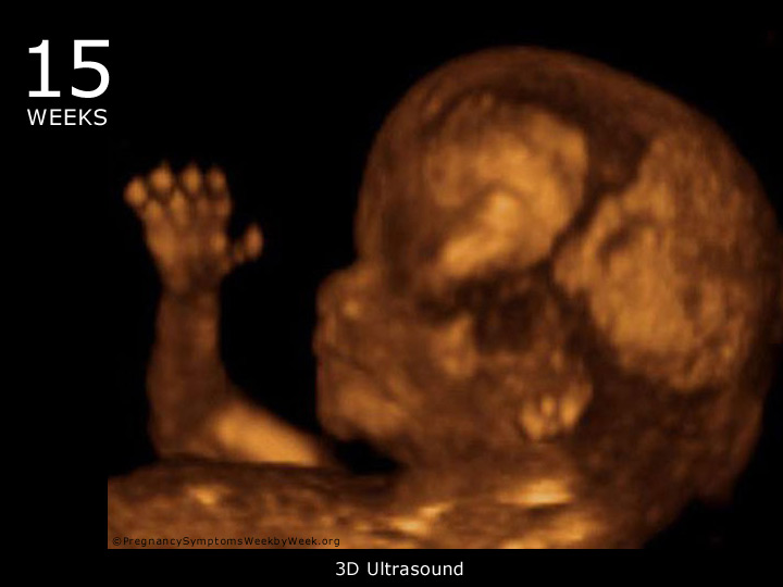 15 week ultrasound 3D