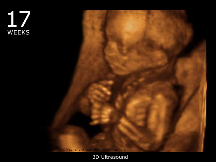 17 week ultrasound 3D