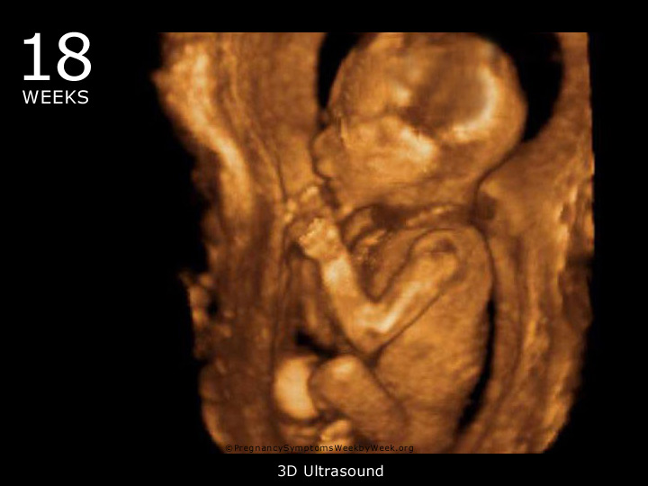 18 week ultrasound 3D