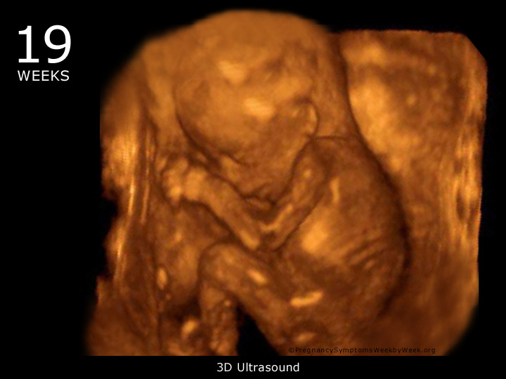 19 week ultrasound 3D
