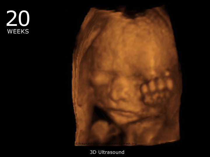 20 week ultrasound 3D
