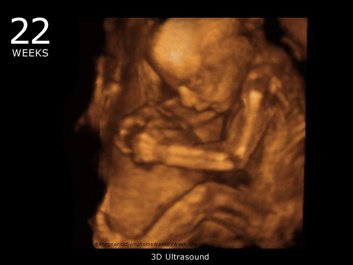 22 week ultrasound 3D