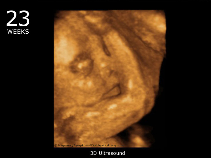 23 week ultrasound 3D