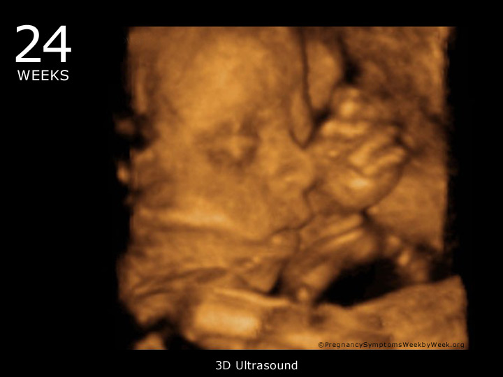Pregnancy Ultrasound Week 24