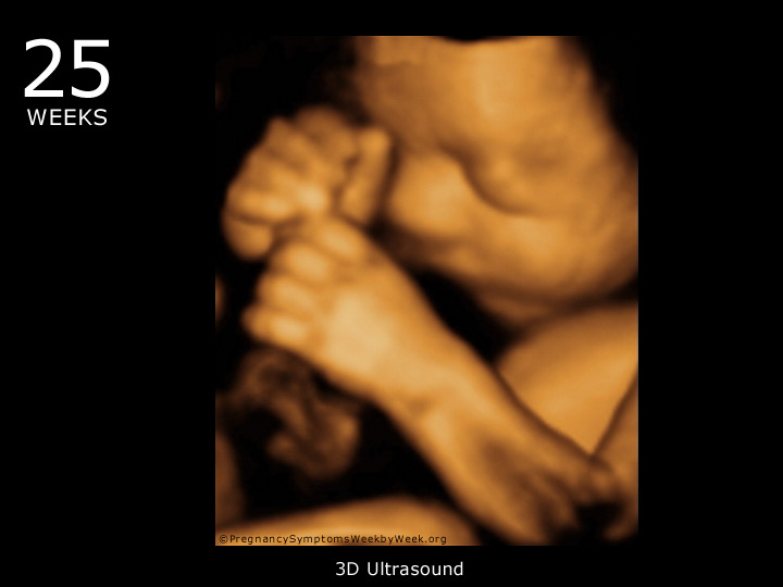 25 week ultrasound 3D