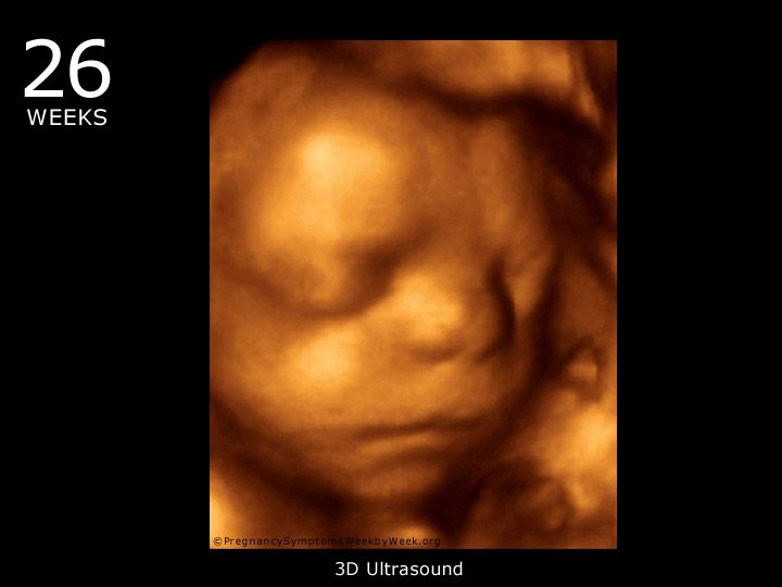 26 week ultrasound 3D