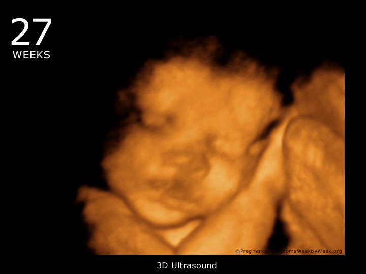 27 week ultrasound 3D