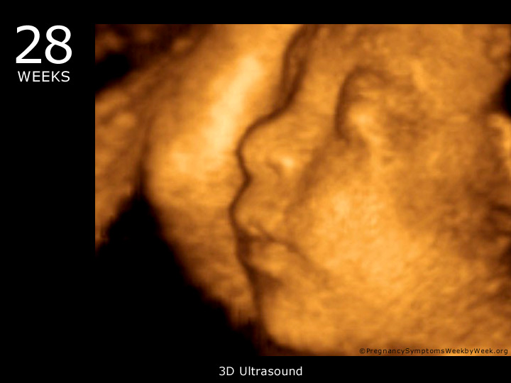 28 week ultrasound 3D