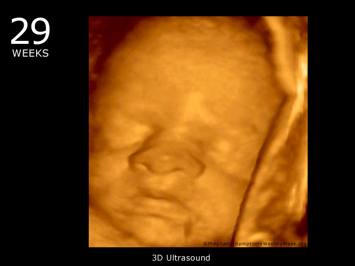 29 week ultrasound 3D
