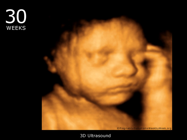 30 week ultrasound 3D