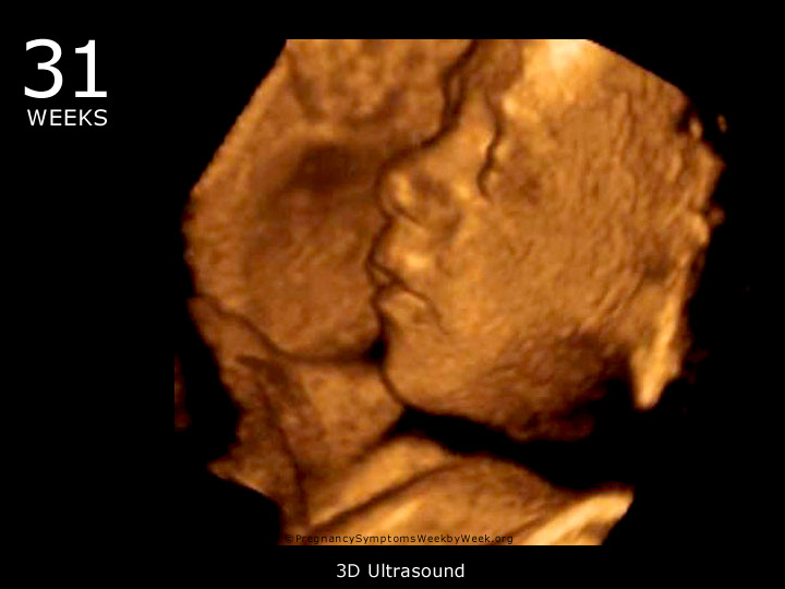 31 week ultrasound 3D