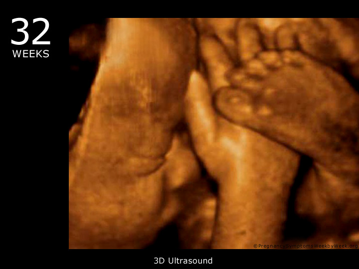 32 week ultrasound 3D