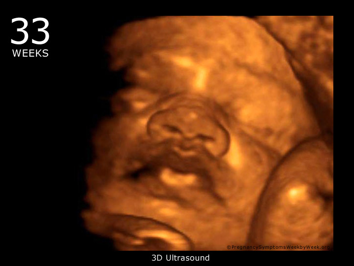33 week ultrasound 3D