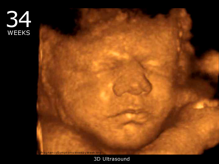34 week ultrasound 3D
