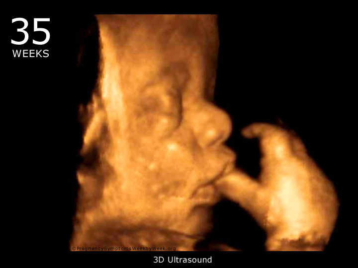 35 week ultrasound 3D