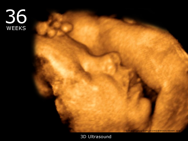 36 week ultrasound 3D