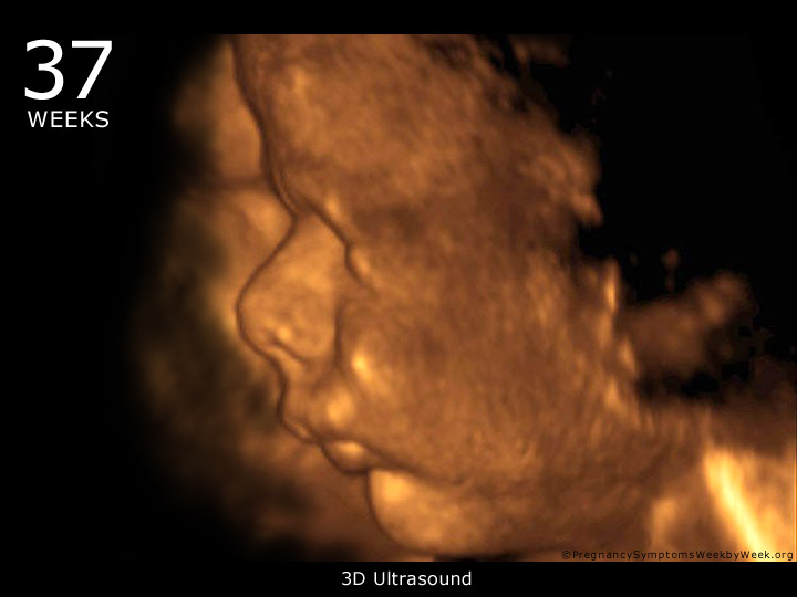37 week ultrasound 3D