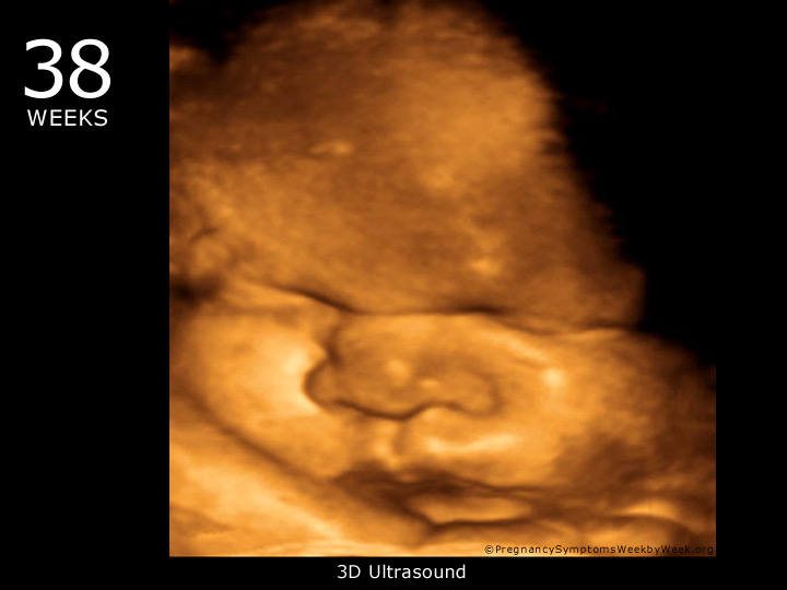 38 week ultrasound 3D