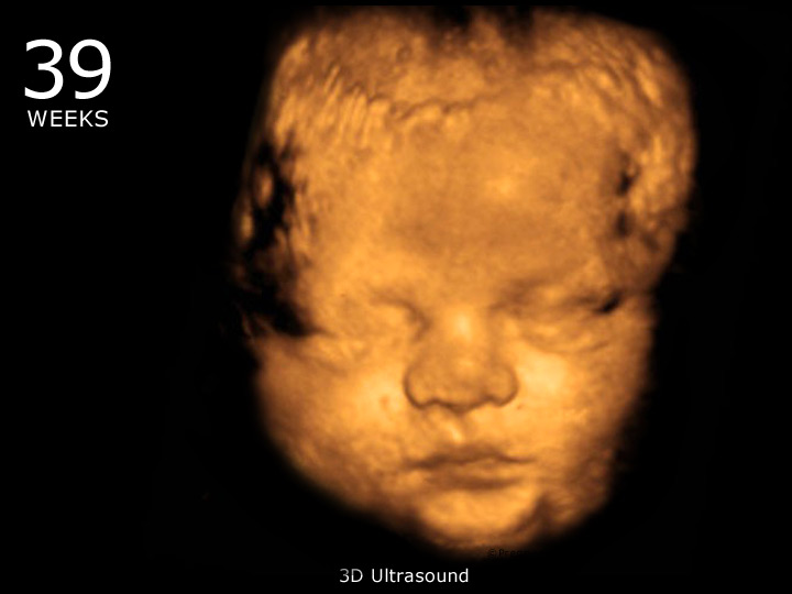 39 week ultrasound 3D