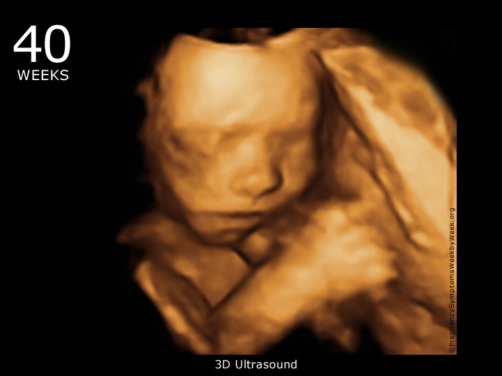 40 week ultrasound 3D