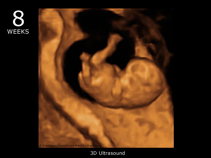 8 week ultrasound 3D